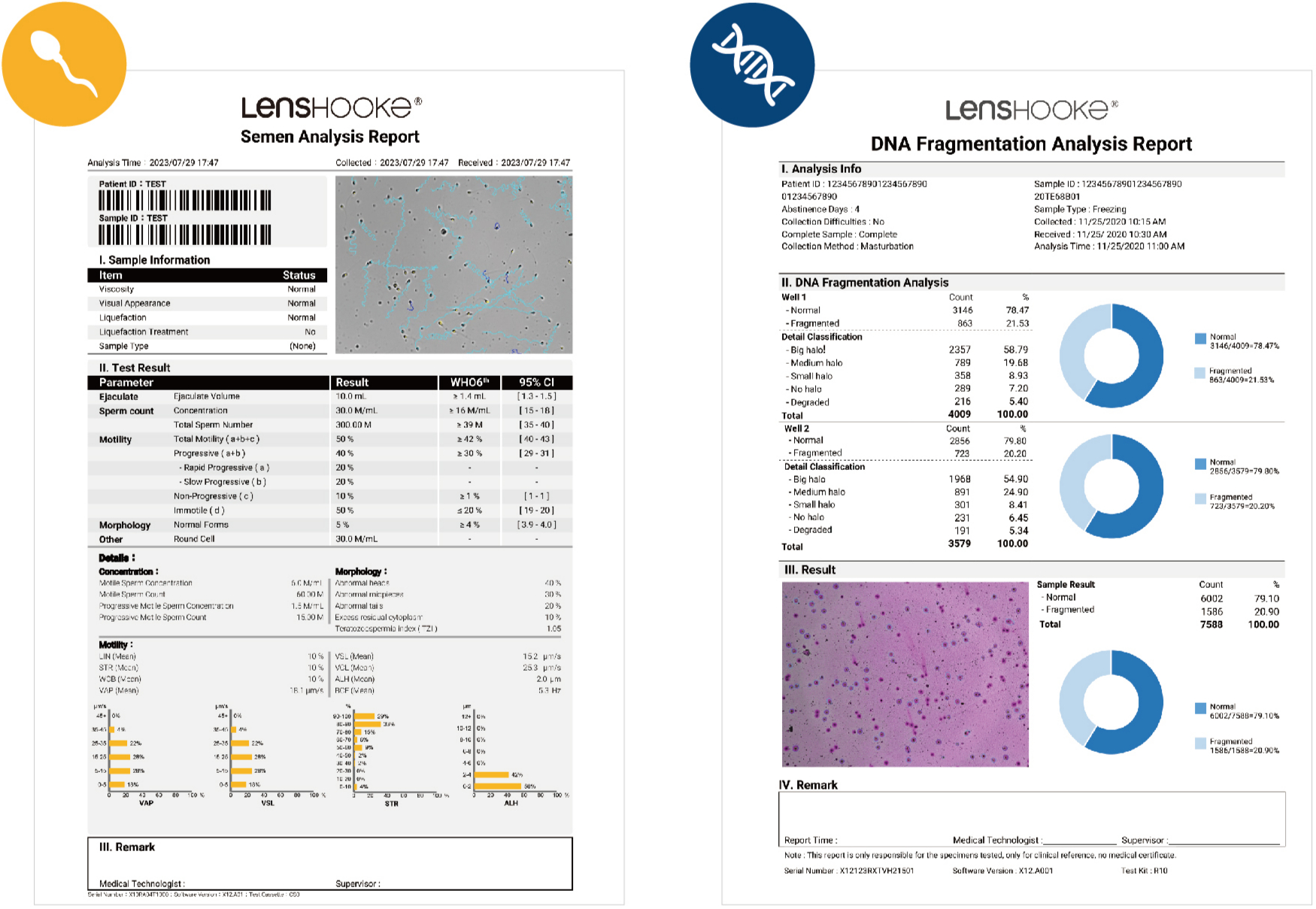 LensHooke X12 Pro rapport