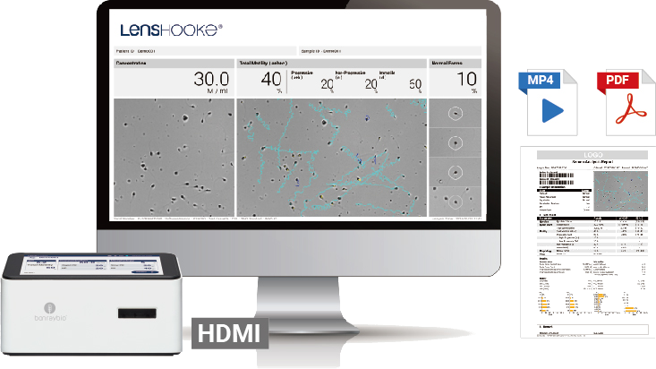 Result shown on X3 Pro touchscreen